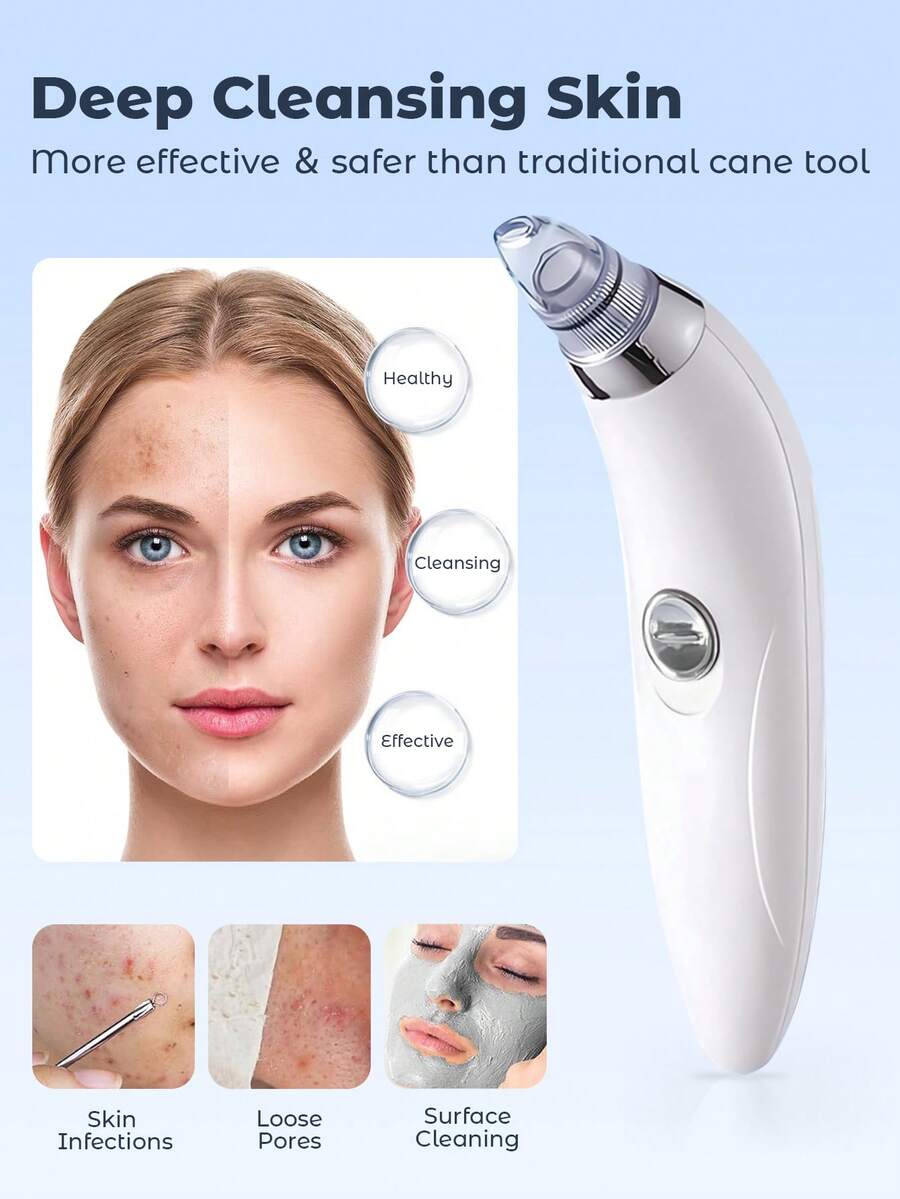 Blackhead Vacuum Remover, Powerful Portable Facial Pore Cleaner With 4 Probes, Remove Blackhead In Gentle And Way Without Squeezing Pain For Women And Men. Your Personal Professional Beautician.