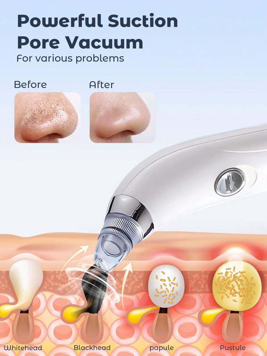 Blackhead Vacuum Remover, Powerful Portable Facial Pore Cleaner With 4 Probes, Remove Blackhead In Gentle And Way Without Squeezing Pain For Women And Men. Your Personal Professional Beautician.